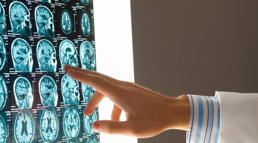 Organizational Characteristics that Lead to Colocation of Mental Health in Primary Care Services for Veterans